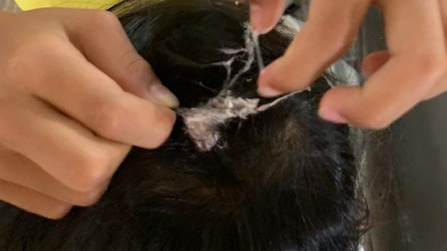 gum on hair