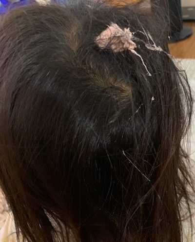gum on hair